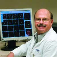 Mapping the Brain