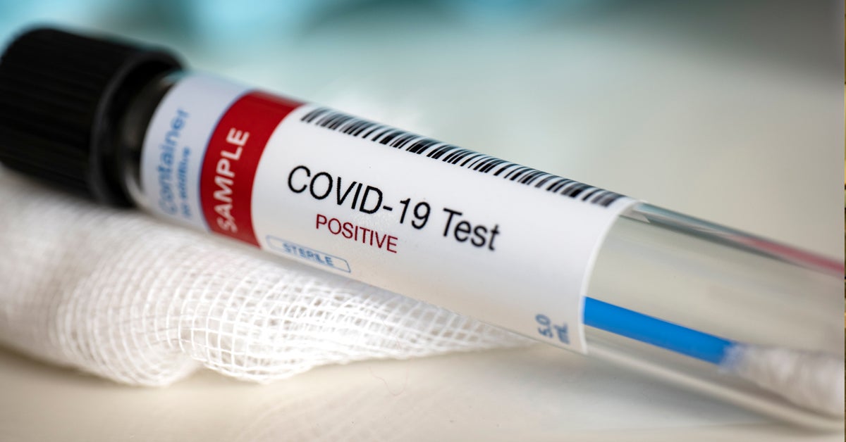 COVID-19 Test