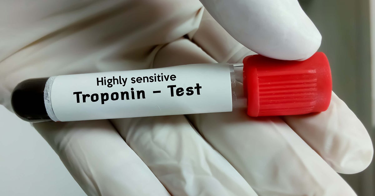 Highly Sensitive Troponin