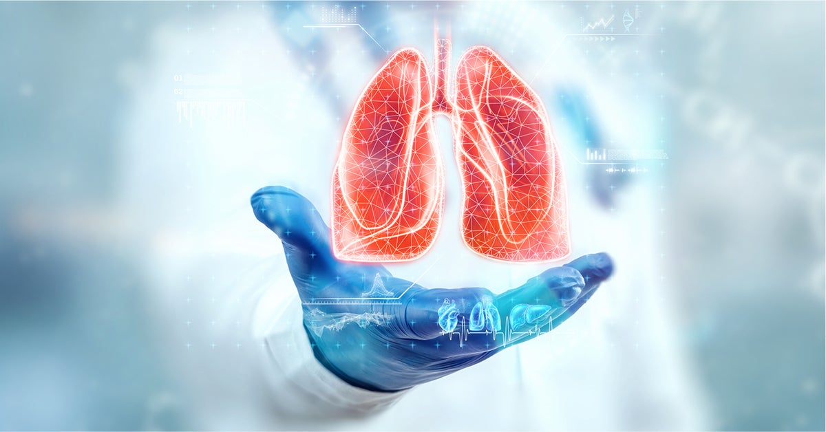 Pilot Lung Screening Program at LVHN Expands