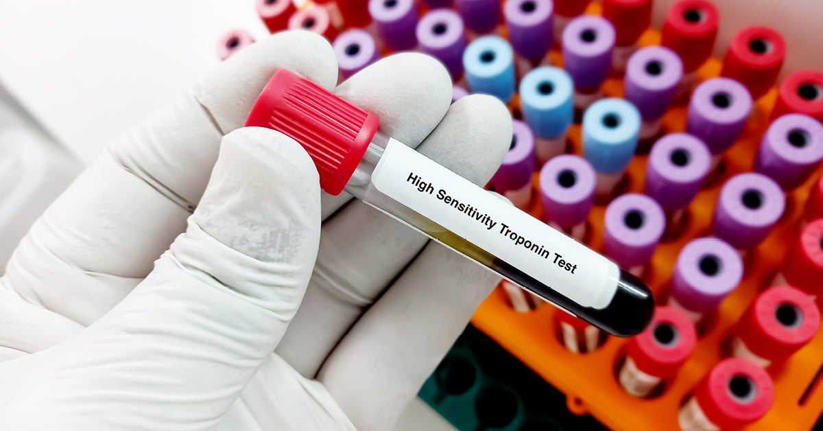 High-sensitivity troponin testing 