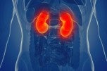Kidney Cancer