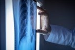 Lung Cancer Screening and Diagnosis