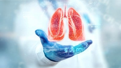 Pilot Lung Screening Program at LVHN Expands