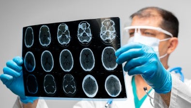 September is Brain Aneurysm Awareness Month