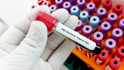 High-sensitivity troponin testing 