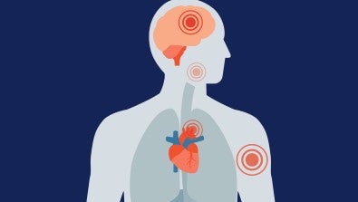 Know the top symptoms for different heart conditions