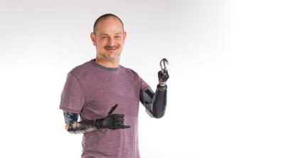 Amputee Awareness Day event April 18 at Lehigh Valley Hospital–Cedar Crest.