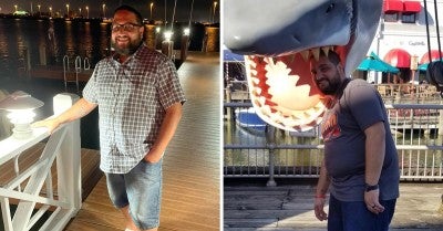 Bariatric surgery helps Frankie Torres steer toward a happier, healthier life.