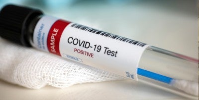 COVID-19 Test