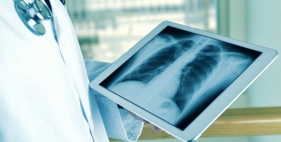 Get the facts about lung cancer at Lehigh Valley Health Network’s upcoming virtual education session.