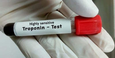 Highly Sensitive Troponin