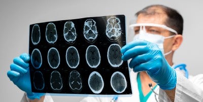 September is Brain Aneurysm Awareness Month