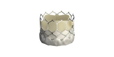 Transcatheter aortic valve replacement (TAVR)