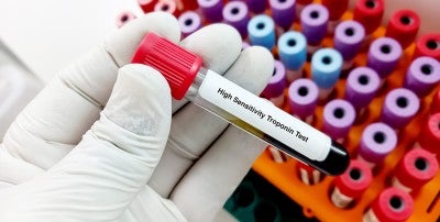 High-sensitivity troponin testing 