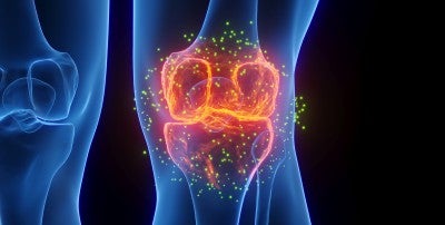 What Is Rheumatoid Arthritis?