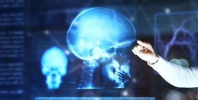 One-of-a-Kind Skull Based Surgery Team at LVHN 