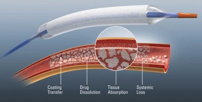 Lehigh Valley Health Network Only in Region to Participate in Drug Coated Balloon Clinical Trial