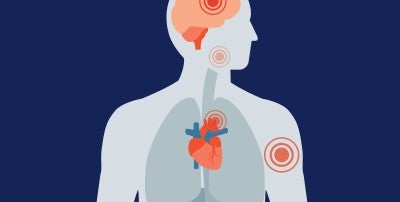 Know the top symptoms for different heart conditions