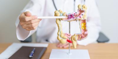 Saturday screenings offer another opportunity to prevent colon cancer