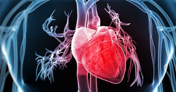 Hypertrophic cardiomyopathy 