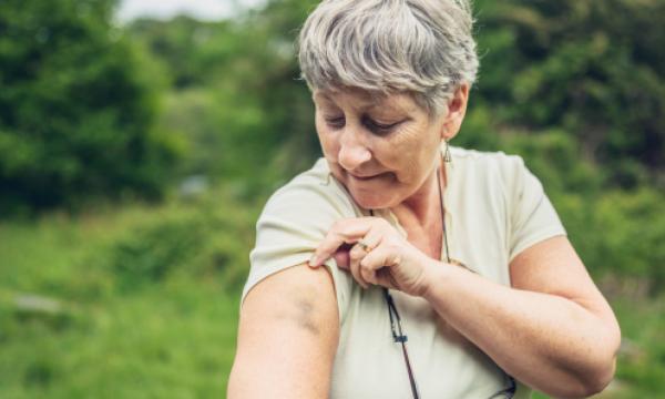 Is it simply bruising or something more? 