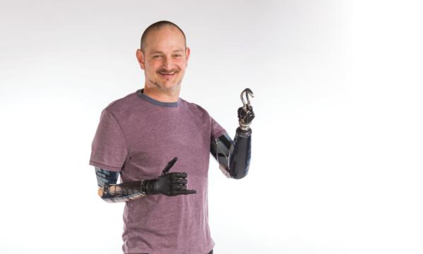 Amputee Awareness Day event April 18 at Lehigh Valley Hospital–Cedar Crest.