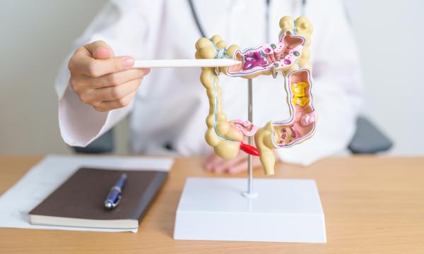 Saturday screenings offer another opportunity to prevent colon cancer