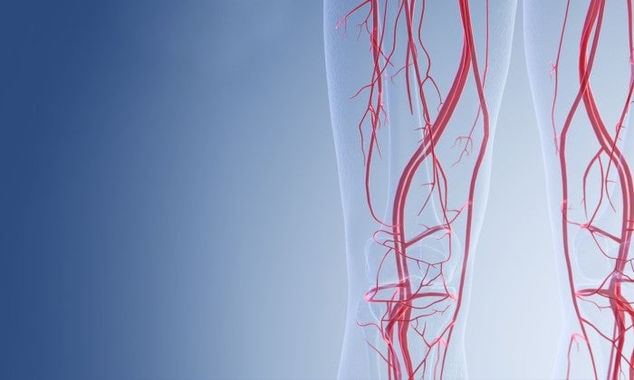 Banner image-Peripheral Vascular