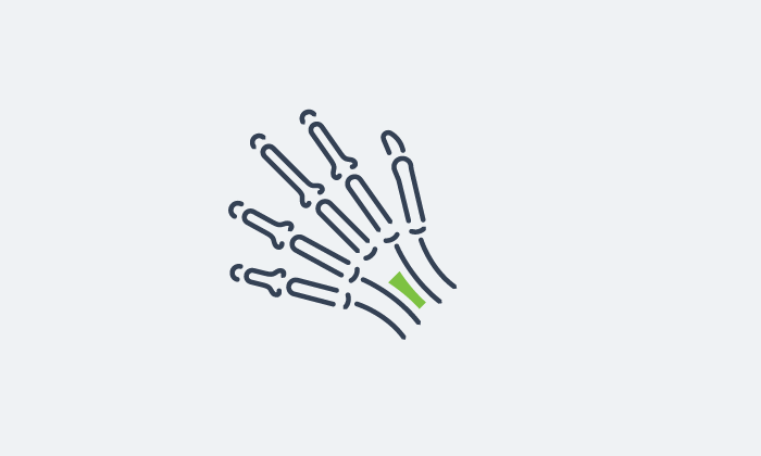 Learn how LVHN treats hand, wrist and elbow pain