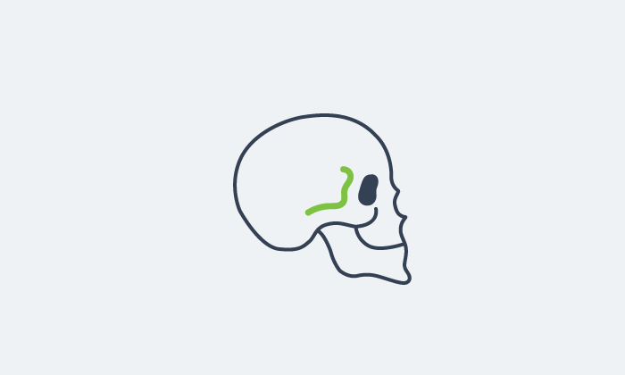 Neuro Institute Skull