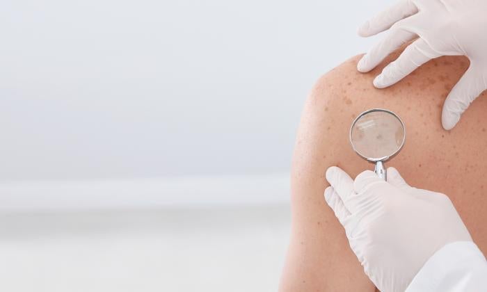 If you’ve noticed a concerning area of your skin, the experts at LVPG Plastic and Reconstructive Surgery are here for you. 