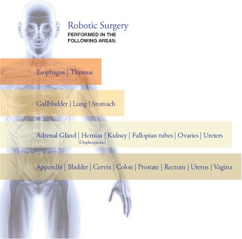 Robotic surgery graphic